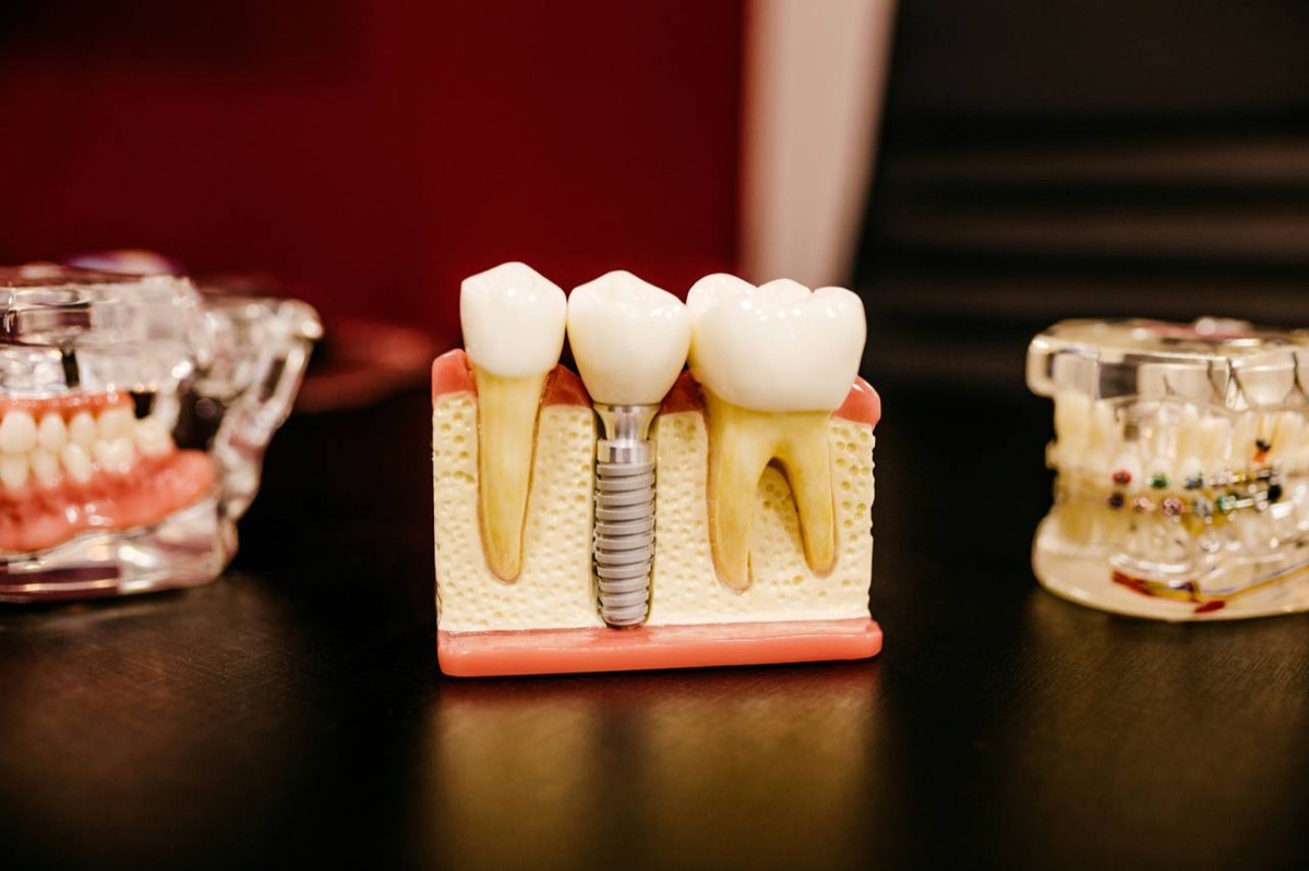 Dental clinic price comparison across European countries